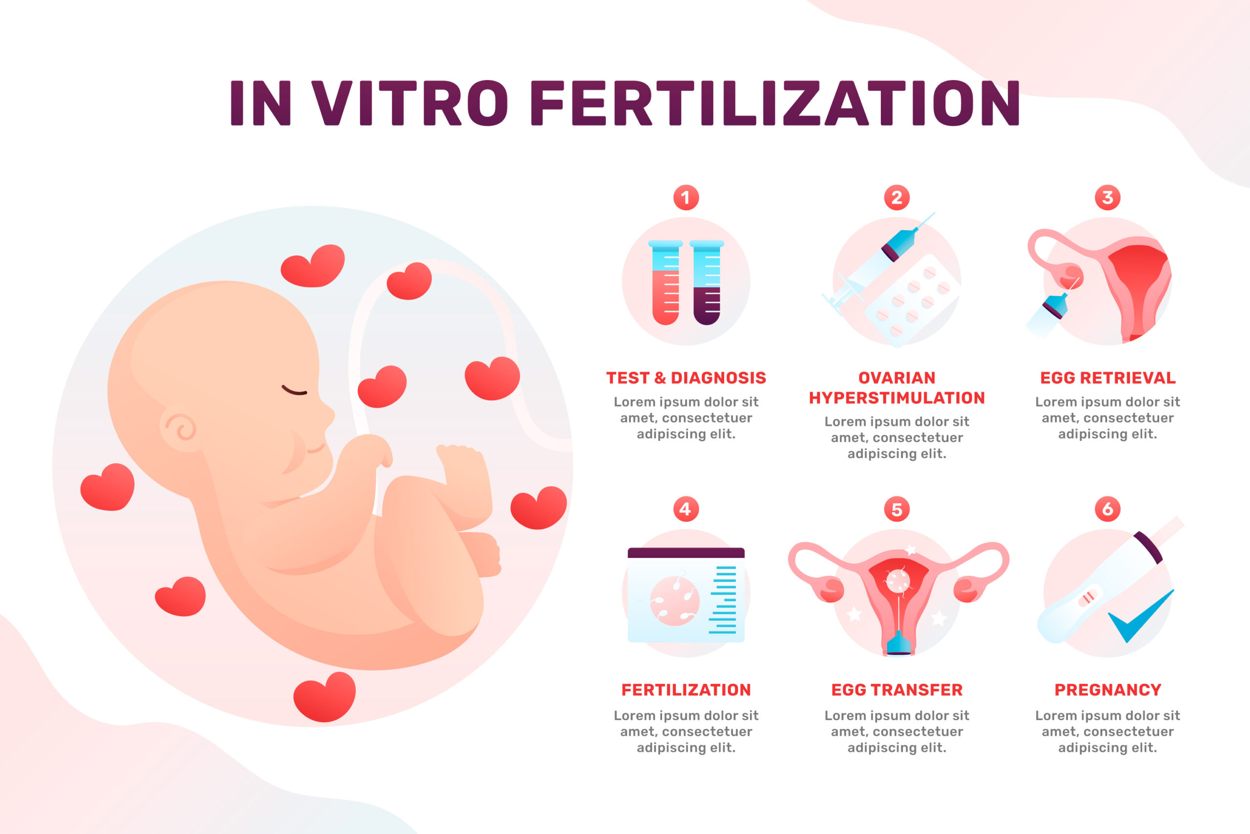 In Vitro Fertilization (IVF)
