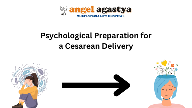 Psychological Preparation for a Cesarean Delivery