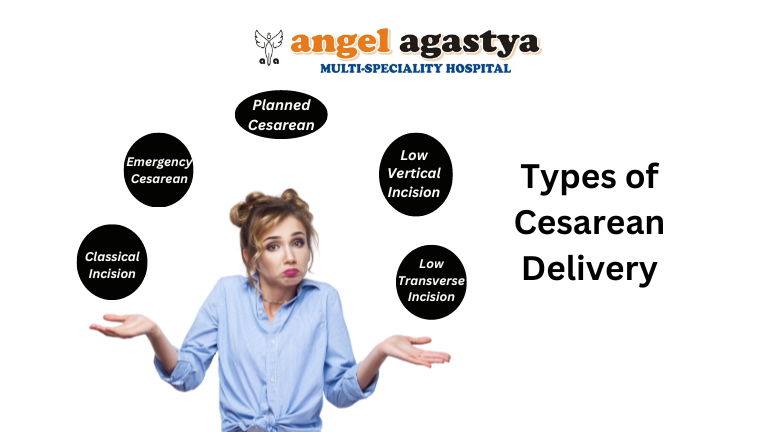 Types of Cesarean Deliveries
