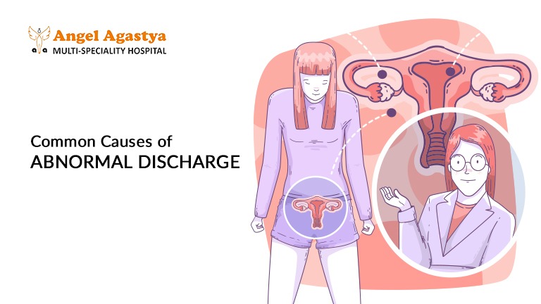 Common Causes of Abnormal Discharge