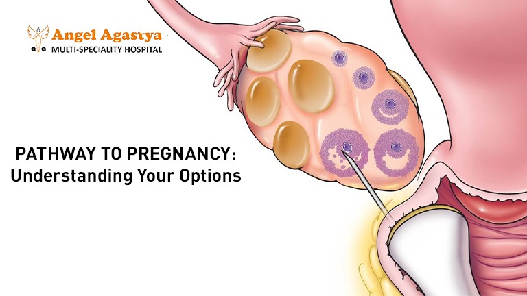 Pathway to Pregnancy : Exploring Your Options with Confidence
