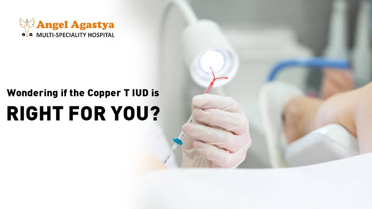 If Copper T IUD is Right for YOU?