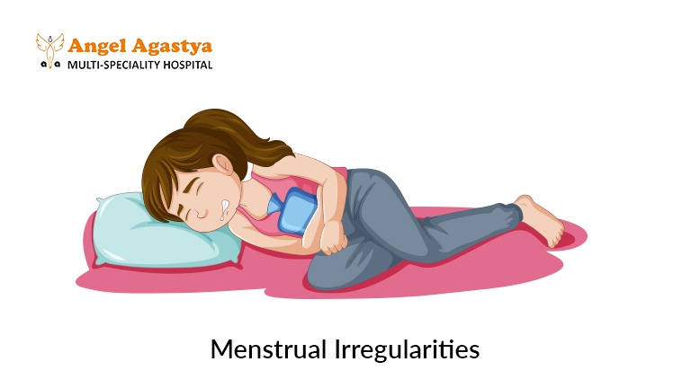 Menstrual Irregularities: Common Gynecological Issues/Concerns
