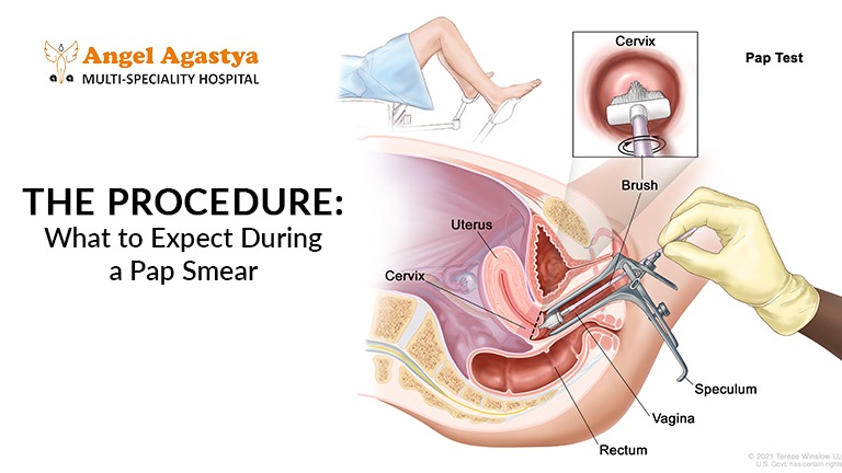 The Procedure: What to Expect During a Pap Smear