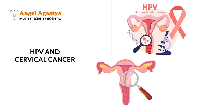 HPV and Cervical Cancer - Angel Agastya