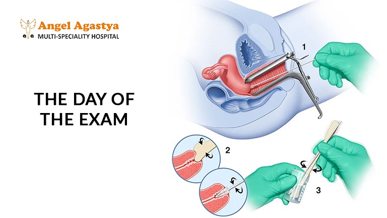 The Day of The Exam: Pap Smear