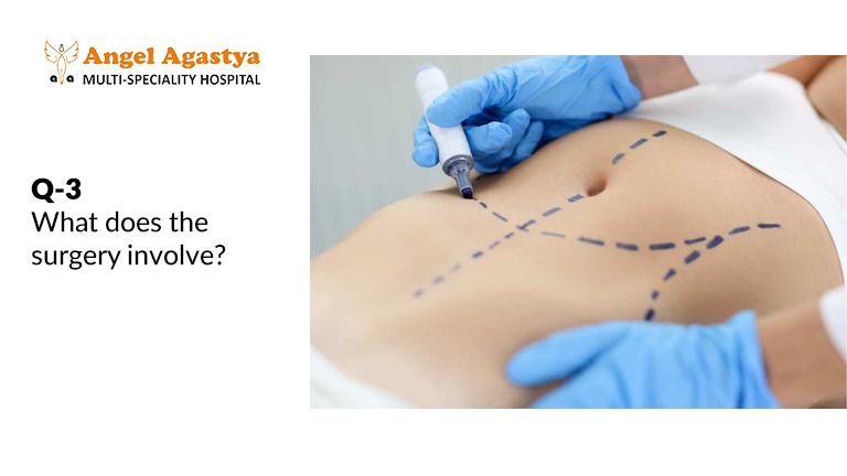 What does the surgery involve?