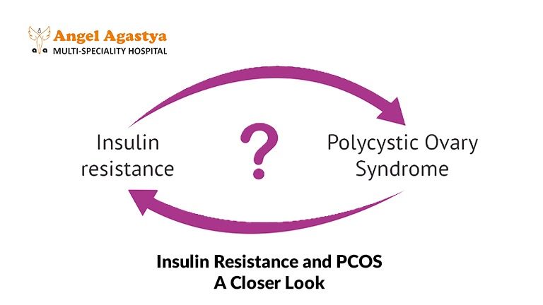 Insulin Resistance & PCOS: A Closer Look