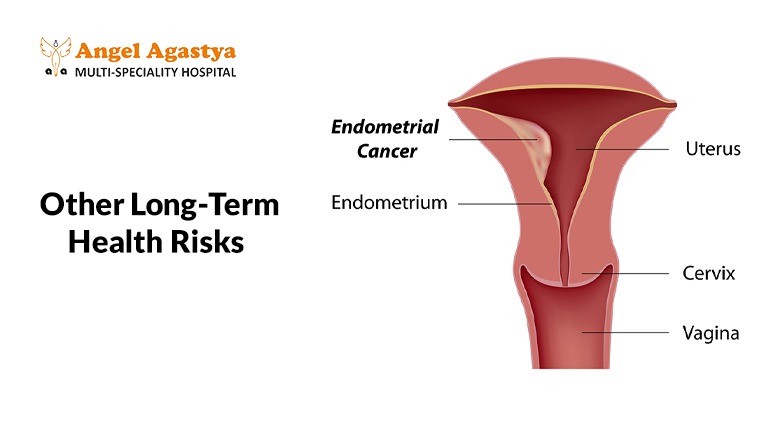 Other Long-Term Health Risks