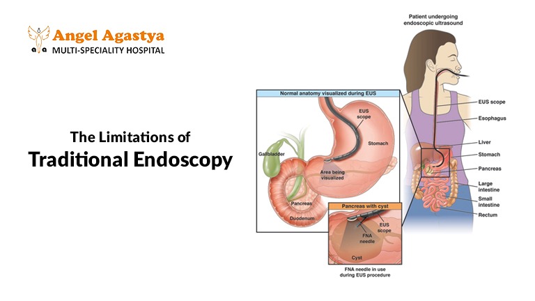 Limitations of Traditional Endoscopy