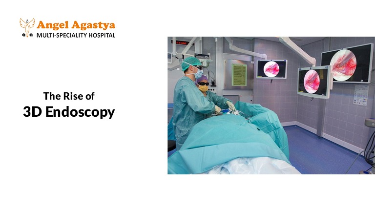 3D and Robotic Endoscopy: