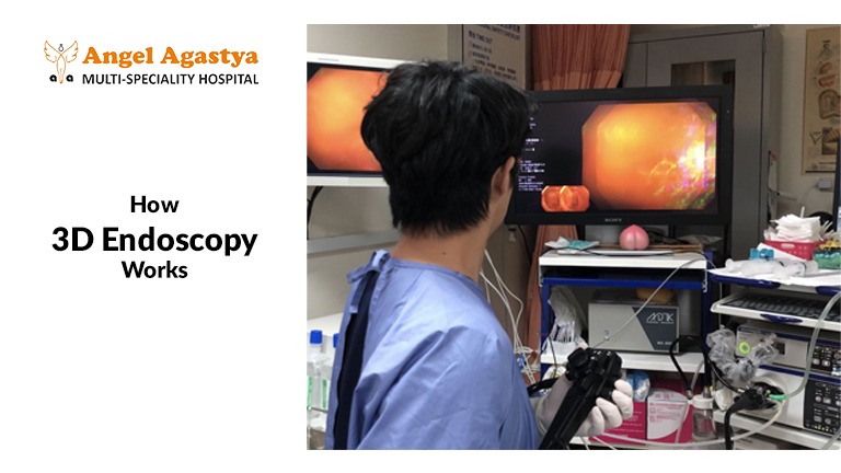 How 3D Endoscopy Works#3D and Robotic Endoscopy