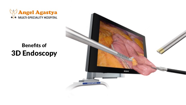 Benefits of 3D Endoscopy and Robotic Endoscopy