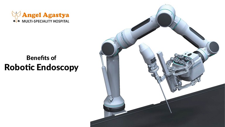 Benefits of Robotic Endoscopy#3D and Robotic Endoscopy