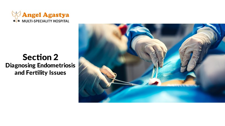Diagnosing Endometriosis and Fertility Issues