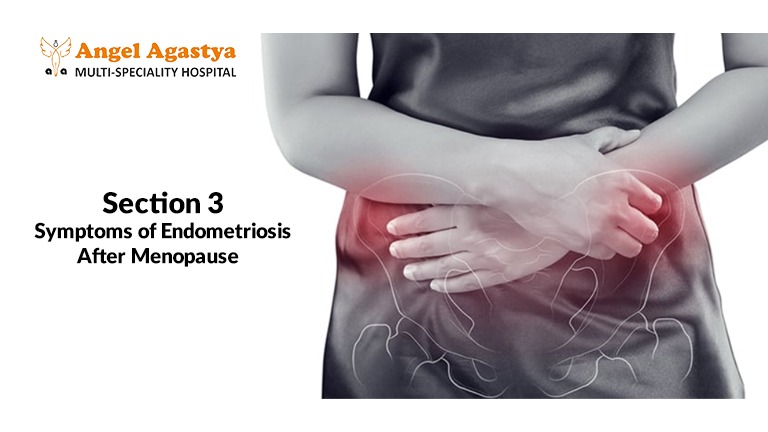 Symptoms of Endometriosis After Menopause