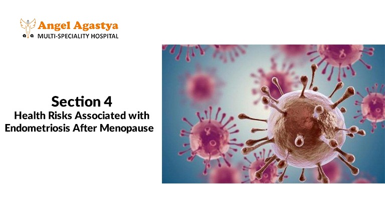 Health Risks Associated with Endometriosis After Menopause