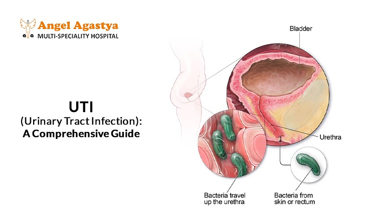 Urinary Tract Infection