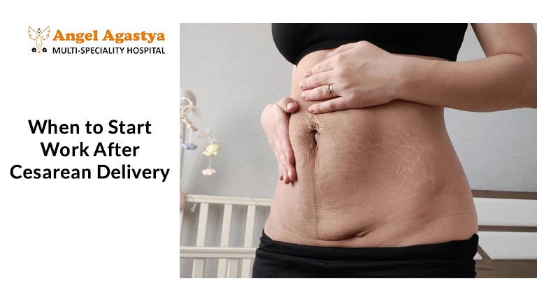 Cesarean Delivery