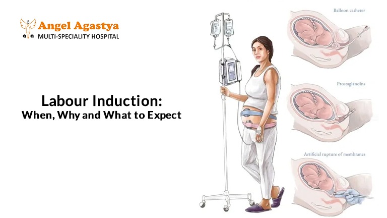 Labour labour induction guide