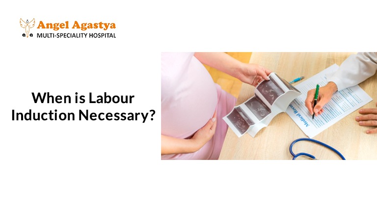 when is labour induction necessary