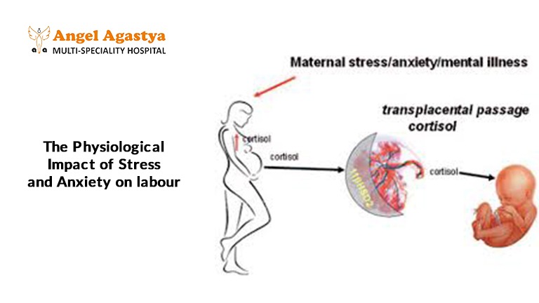 The Physiological Impact of Stress and Anxiety on labour The Physiological Impact of Stress and Anxiety on labour
