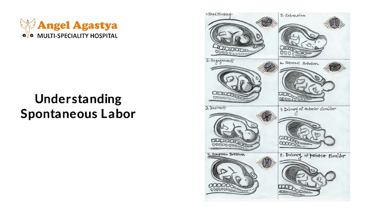 Understanding Spontaneous Labor