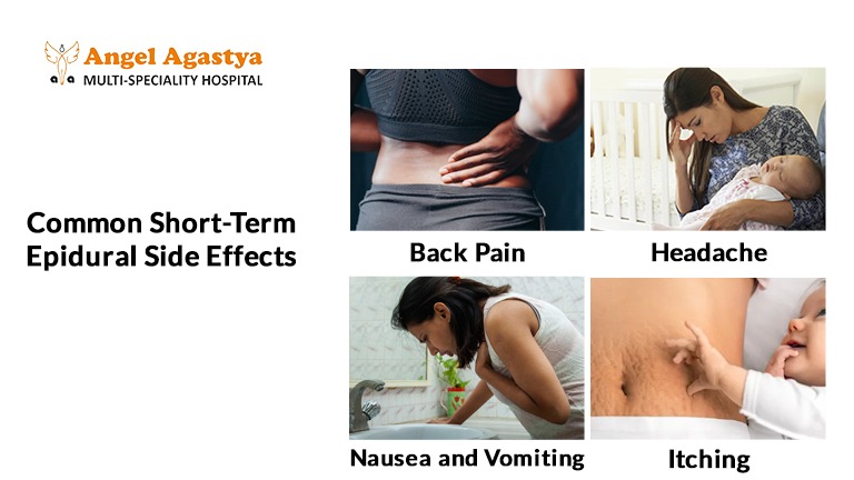 Common Short-Term Epidural Side Effects