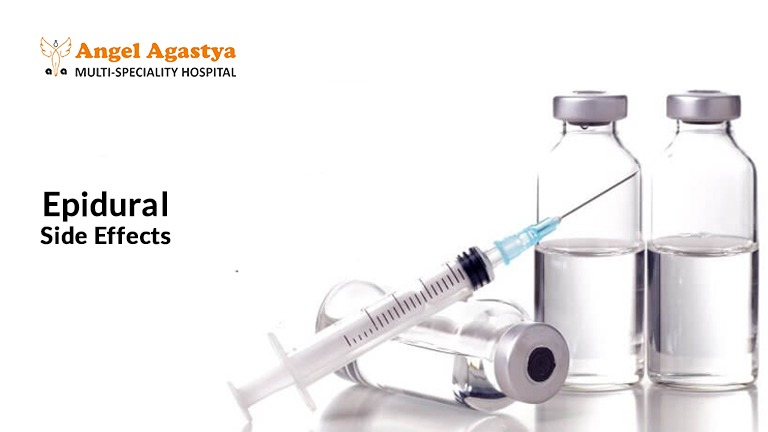 The Truth About Epidural Side Effects