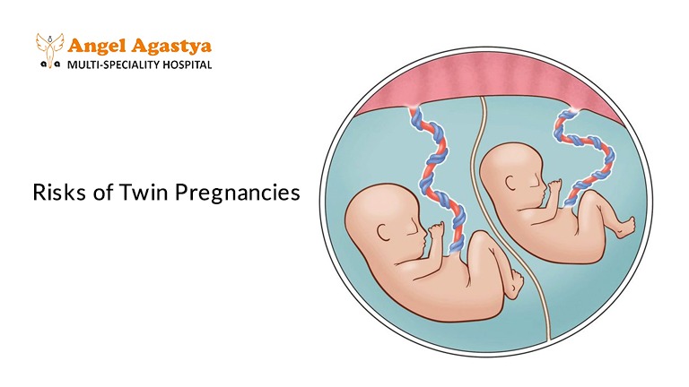 conceive twins.