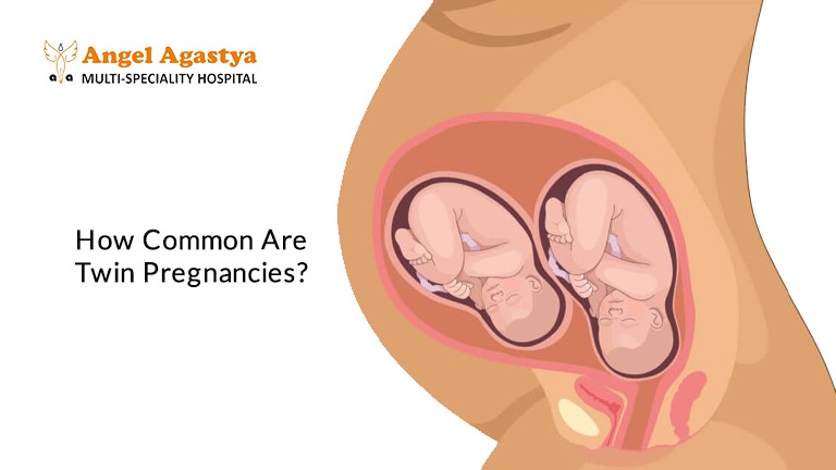 conceive twins