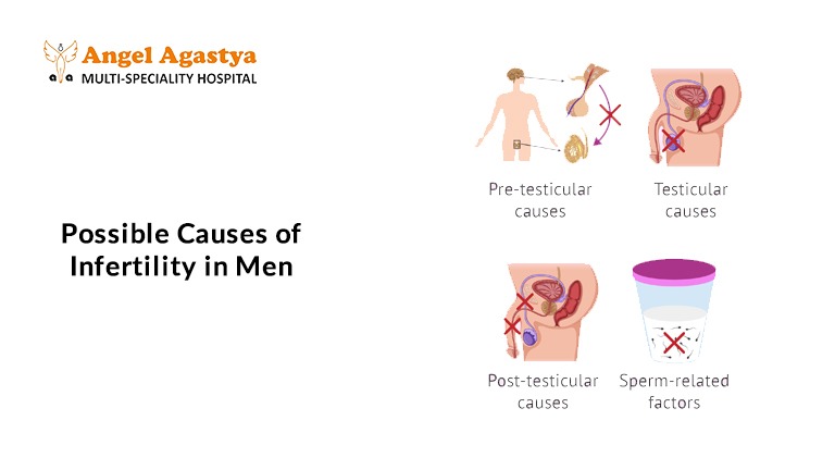 infertility
