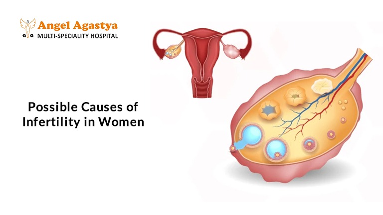 infertility