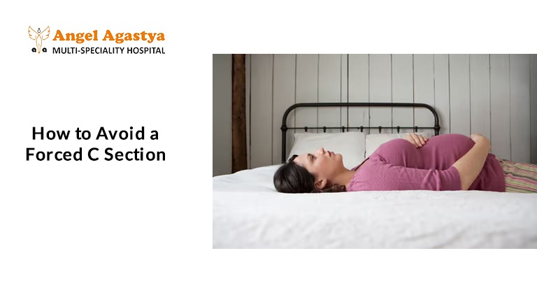 How to Avoid a Forced C Section
