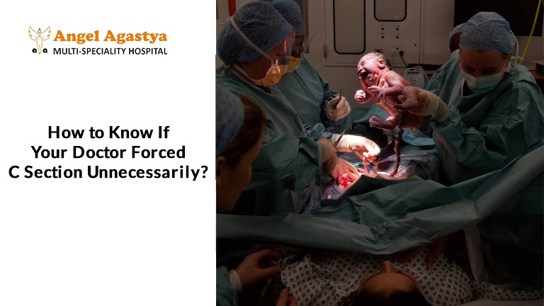 How to Know If Your Doctor Forced C Section Unnecessarily