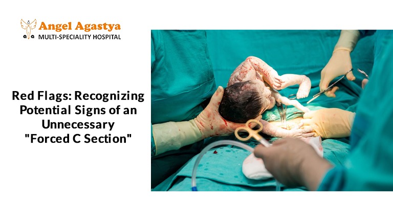 Red Flags Recognizing Potential Signs of an Unnecessary Forced C Section