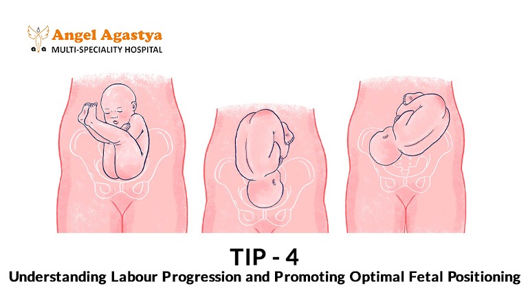 Tip 4: Understanding Labour Progression and Promoting Optimal Fetal Positioning
