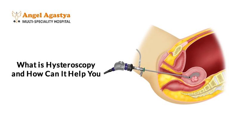 What Is Hysteroscopy and How it can help What Is Hysteroscopy and How it can help