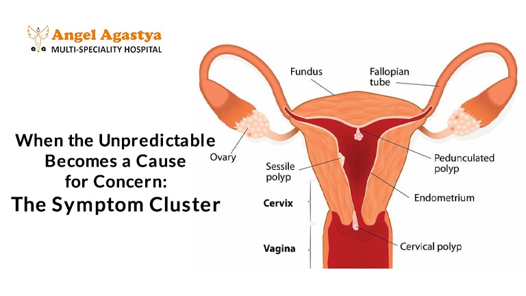 When the Unpredictable Becomes a Cause for Concern The Symptom Cluster