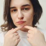 Close-up of a woman with acne touching her face, highlighting skin care concerns.