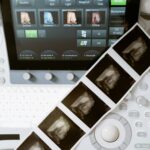 Ultrasound machine displaying 3D scans, with printed sonogram images adjoining.