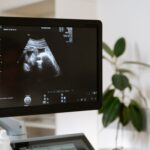 Medical ultrasound scan showing a fetus on a monitor in a clinic setting.