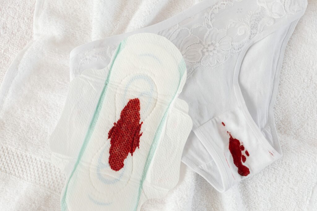 Close-up of a sanitary pad and underwear with menstrual blood stains on a white towel.